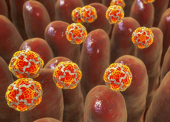 Virus hepatitidy A. Proti tomuto onemocnní je moné se okovat.