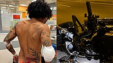 Ben Cristovao m�l nehodu na motorce, na Instagramu ukázal svá zran�ní. (srpen...