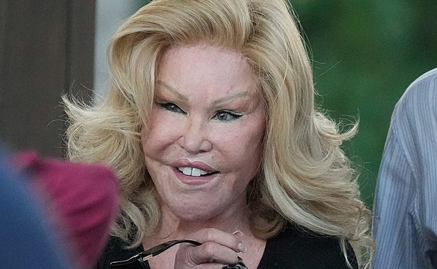 Kočičí žena Jocelyn Wildensteinová ukázala, jak vypadala před plastikami