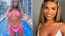 Influencerka se nem��e smí�it s tím, jak vypadá její nový chrup.