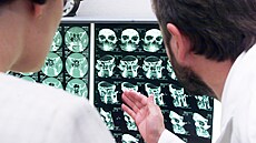 �adu neurologických potí�í odhalí nejen konkrétní projevy pacienta, ale i...