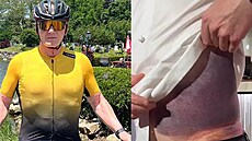 Gordon Ramsay ukázal pohmodniny po nehod na kole.