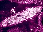 Bakterie Legionella pneumophila jsou pvodcem legionáské nemoci, co je typ...