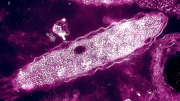 Bakterie Legionella pneumophila jsou p�vodcem legion��sk� nemoci, co� je typ plicn�ho onemocn�n�.