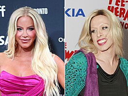 N�které známé osobnosti mají za sebou zm�nu pohlaví.