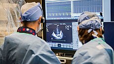 Kardiologové v Ba�ov� nemocnici ve Zlín� za�ali arytmii lé�it pomocí pulzního...