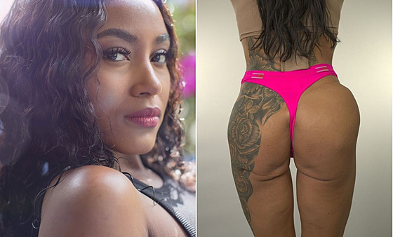 �ena m�la zdeformovaný zadek.