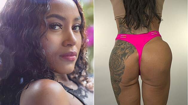 �ena m�la zdeformovan� zadek.