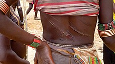 Následky lehání jsou drastické. 