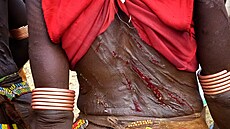 Následky lehání jsou drastické. 