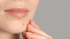 Ilustra�ní fotografie