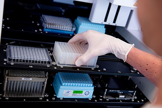 Nepodce�ujte genetick� vy�et�en� v t�hotenstv� � odhal� i z�va�n� vady