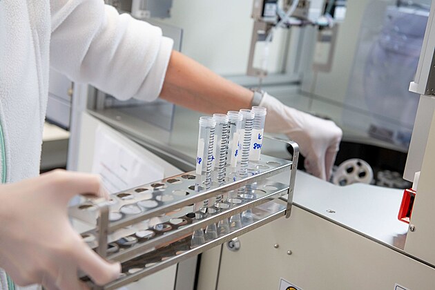 Nepodce�ujte genetick� vy�et�en� v t�hotenstv� � odhal� i z�va�n� vady