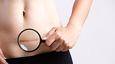 ilustra�ní snímek