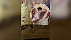 Tvá armáda je ubohá, umíráme zbyte�n�, vzkazuje zran�ný Severokorejec Putinovi