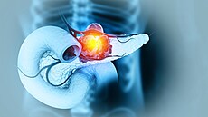 Ilustra�ní fotografie