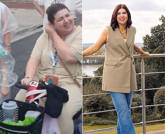 D�íve byla �ena morbidn� obézní.