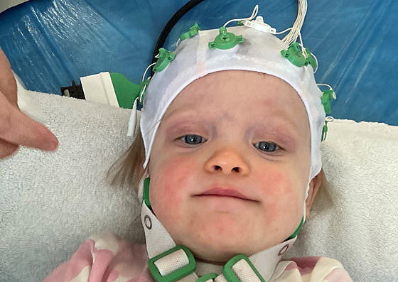 Dvouletá Freya trpí vzácnou genetickou nemocí, kv�li které podstupuje ka�dý...