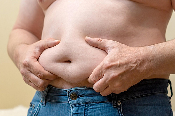 Obezita. (ilustra�ní foto)