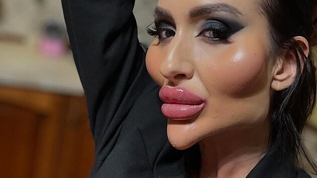 Anastasiia Pokres�ukov�