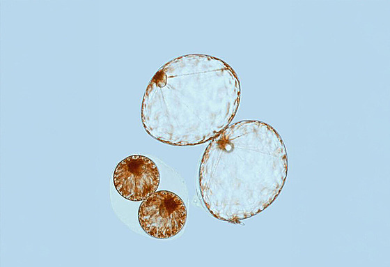 Pyrocystis noctiluca