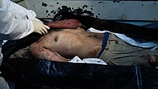 Lidé pátrající po poh�e�ovaných �lenech rodiny se shroma��ují v nemocnici Al...