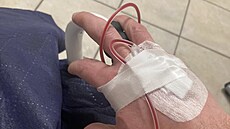 Televizní kutil a moderátor Lá�a Hru�ka si musel volat záchranku. Ukázal fotky...