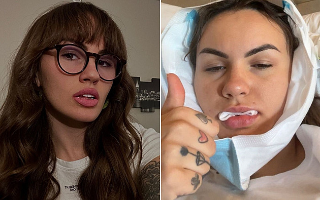 Kvůli drogám přišla žena o zuby, po letech v bolestech má nový chrup