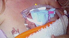 Lucii se dcera narodila ve 25. týdnu t�hotenství, tedy více ne� t�i m�síce p�ed...