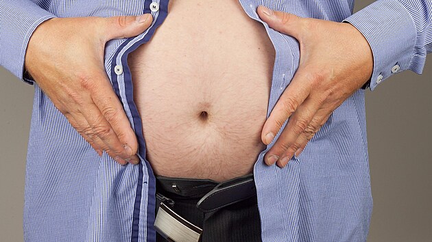 Obezita je nemoc, zvyšuje i riziko rakoviny. Vyhledejte pomoc, radí lékaři