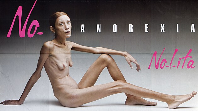 Billboard od italsk�ho fotografa Oliviera Toscaniho. Kampa� poukazuje na probl�m anorexie v m�dn�m pr�myslu.