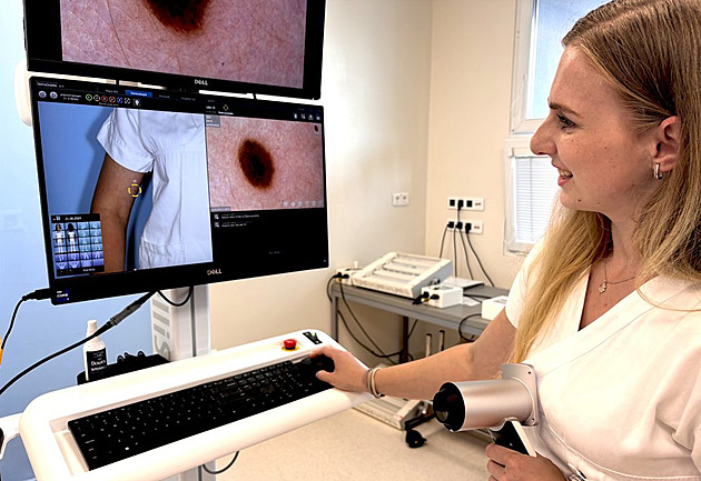 Sledování znamének a dal�ích pigmentových zm�n na t�le pacienta m��e pomoci ke...