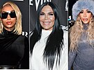 VIP �eny, které p�iznaly plastiky intimních partií.