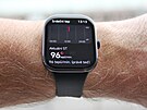 Xiaomi Redmi Watch 5