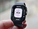 Xiaomi Redmi Watch 5