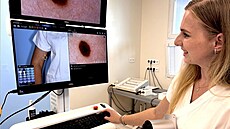 Sledování znamének a dalích pigmentových zmn na tle pacienta me pomoci ke...