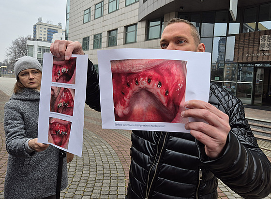 Jako d�kazní materiál slou�í i znalecké posudky