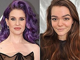 Slavní propadli snadnému hubnutí díky Ozempicu..