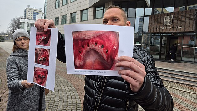 Jako d�kazn� materi�l slou�� i znaleck� posudky