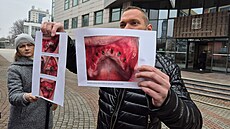 Jako dkazní materiál slouí i znalecké posudky