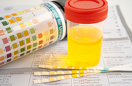 ilustra�ní snímek