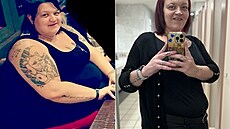 �ena pro�la velkou prom�nou a zbavila se morbidní obezity.