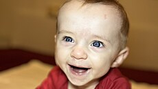 Specializovaná operace m��e Kry�tofovi narovnat nohy. V �esku se ale neprovádí,...