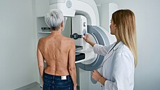 Revolu�ní technologie v lé�b� rakoviny nyní v  Hradce Králové