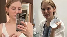 Meghan Trainorová p�ed plastikou