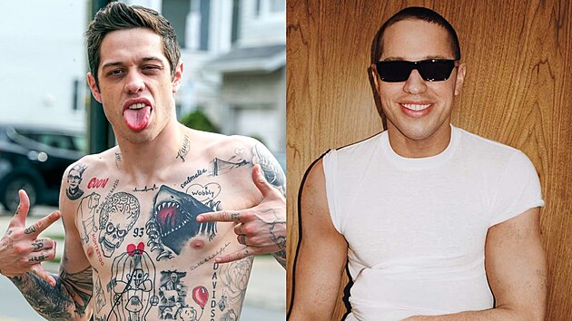 Pete Davidson si nech�v� z t�la odstranit tetov�n� (2025)