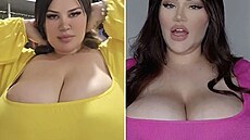 �enu trápí ob�í poprsí, které navíc neustále roste.