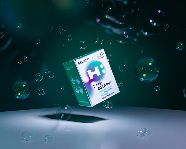 Kde mm ty kle? Konen pe clen na vkon mozku