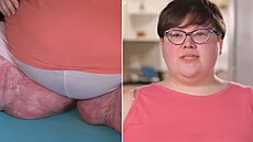 ena má velké problémy s kí. Trpí bolestmi a neustále má potebu se krábat.