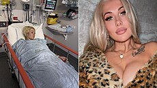 Bizarní nehoda �en� zm�nila �ivot.